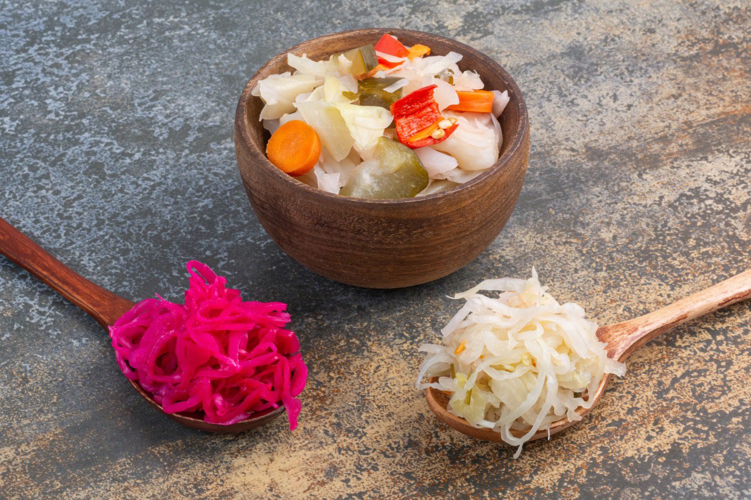 Unveiling the Gut Health Connection in Parkinson's Disease Progression