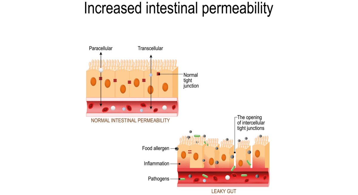 1 Does Leaky Gut Really Exist Does Leaky Gut Really Exist? Separating Myth from Reality